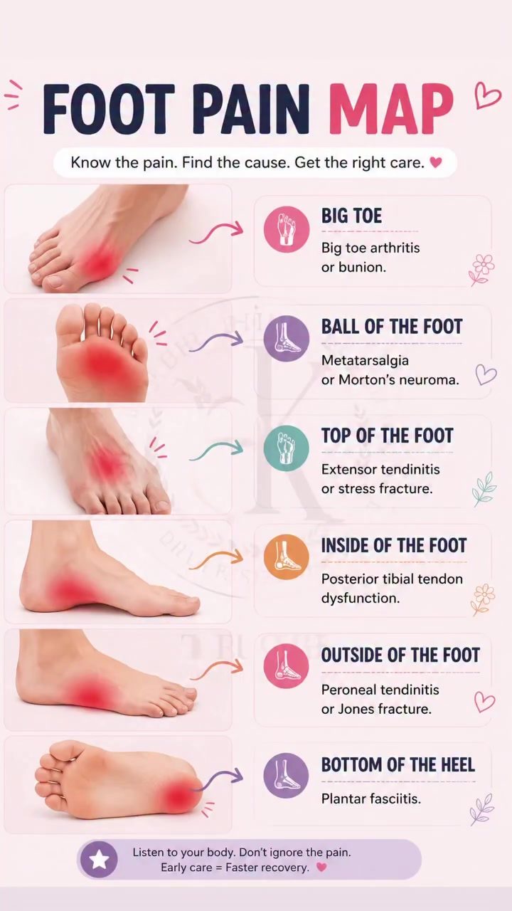 Decoding Your Foot Pain: A Comprehensive Foot Pain Map