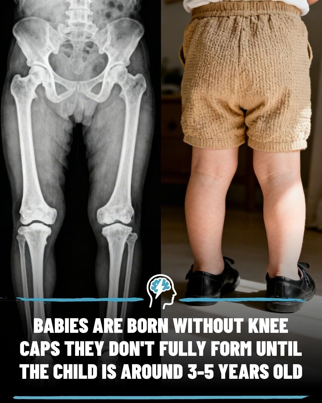 Understanding Baby Knee Development