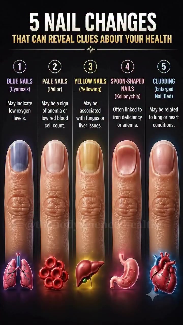 Nail Changes and Their Health Implications