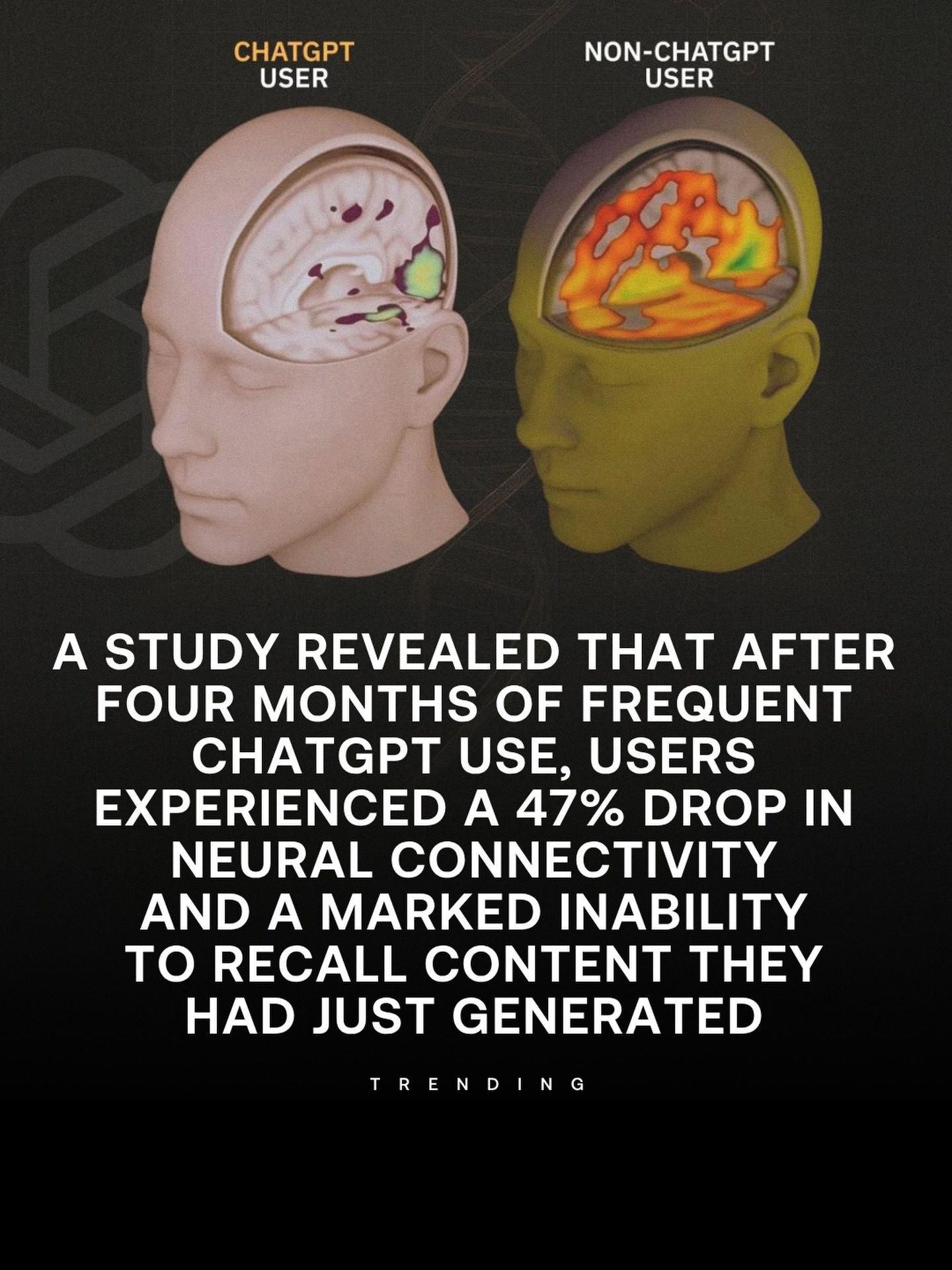 ChatGPT Use Linked to 47% Drop in Neural Connectivity