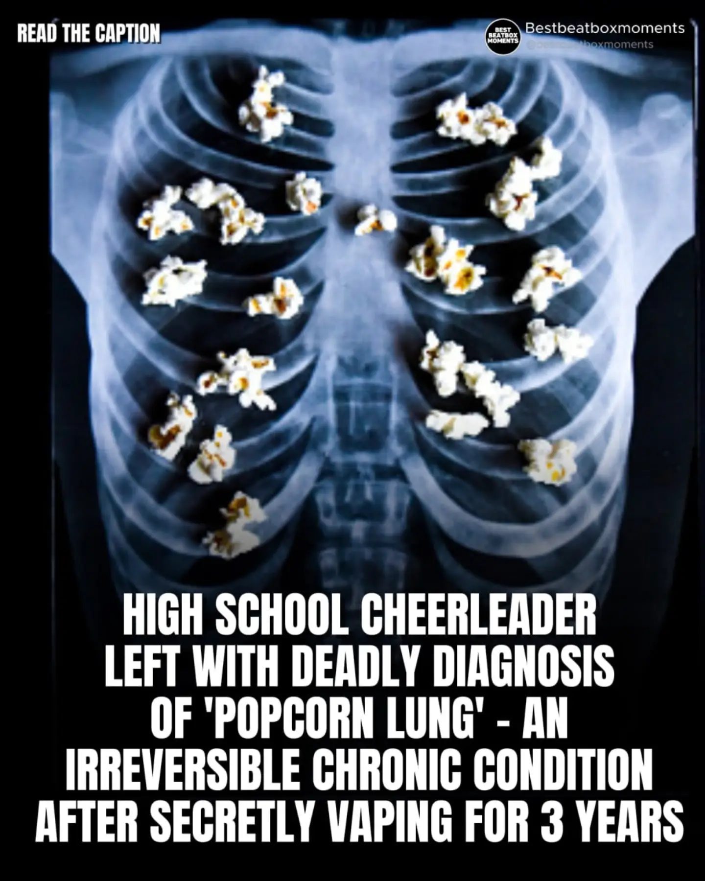 Teen Cheerleader's Warning: The Irreversible Harm of Secret Vaping