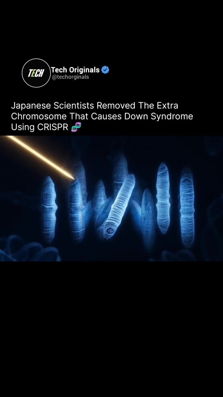 Japanese Scientists Use CRISPR to Target Extra Chromosome in Down Syndrome Breakthrough