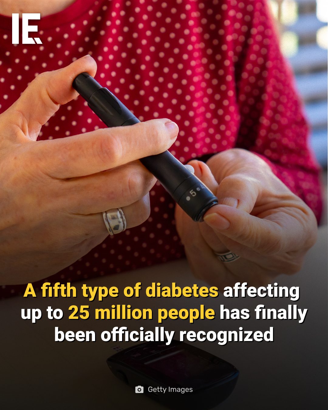 Type 5 Diabetes: Newly Recognized and Affecting Millions