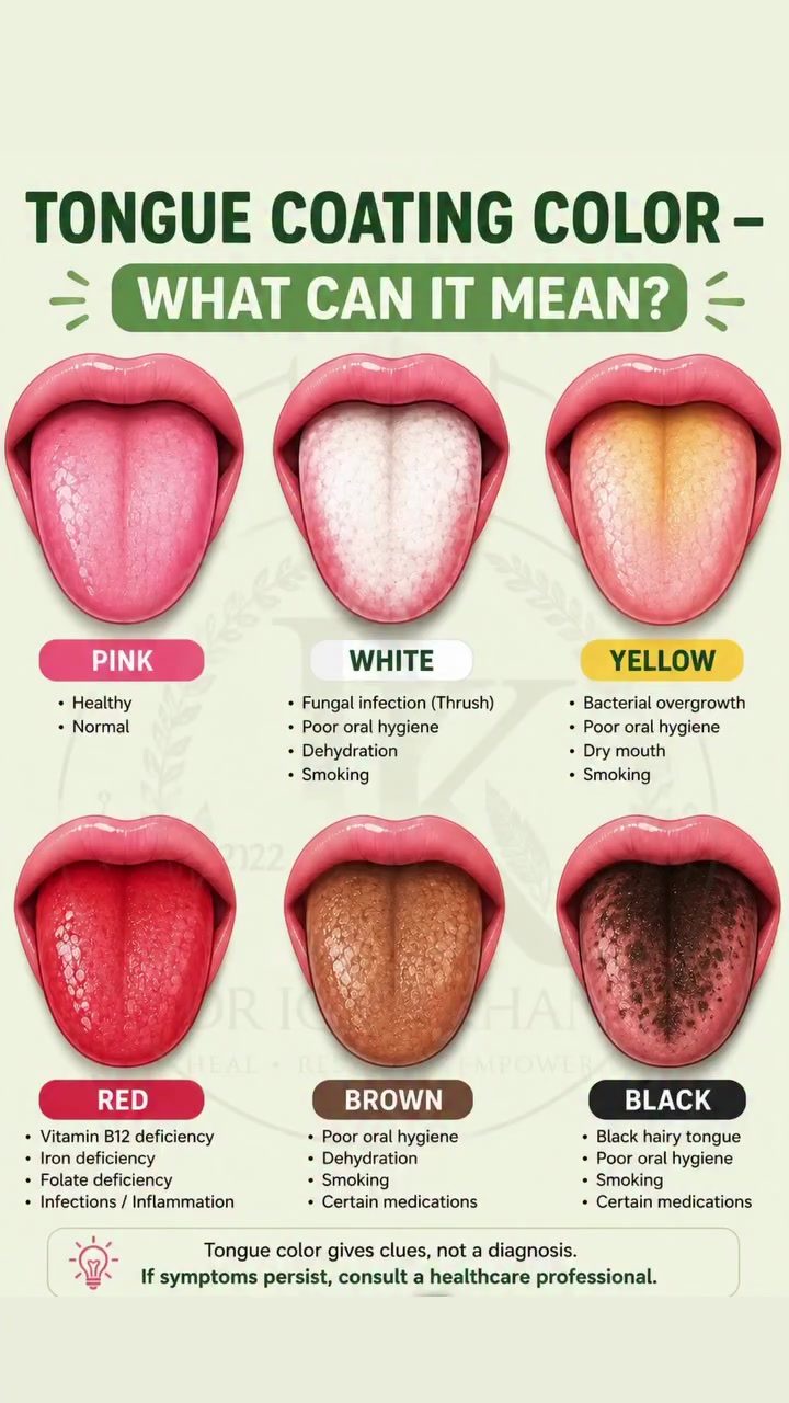 What Your Tongue Color Reveals About Your Health