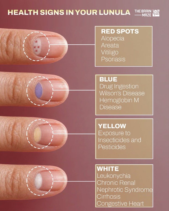 Understanding Your Lunula: Nail Health Signs Explained