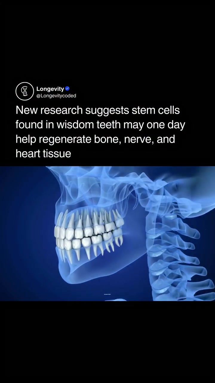 Wisdom Teeth: Future of Regenerative Medicine?