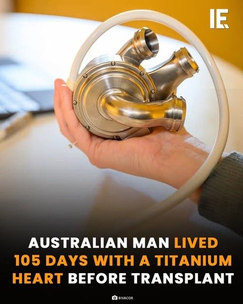 Australian Man's 105-Day Journey with a BiVACOR Titanium Heart