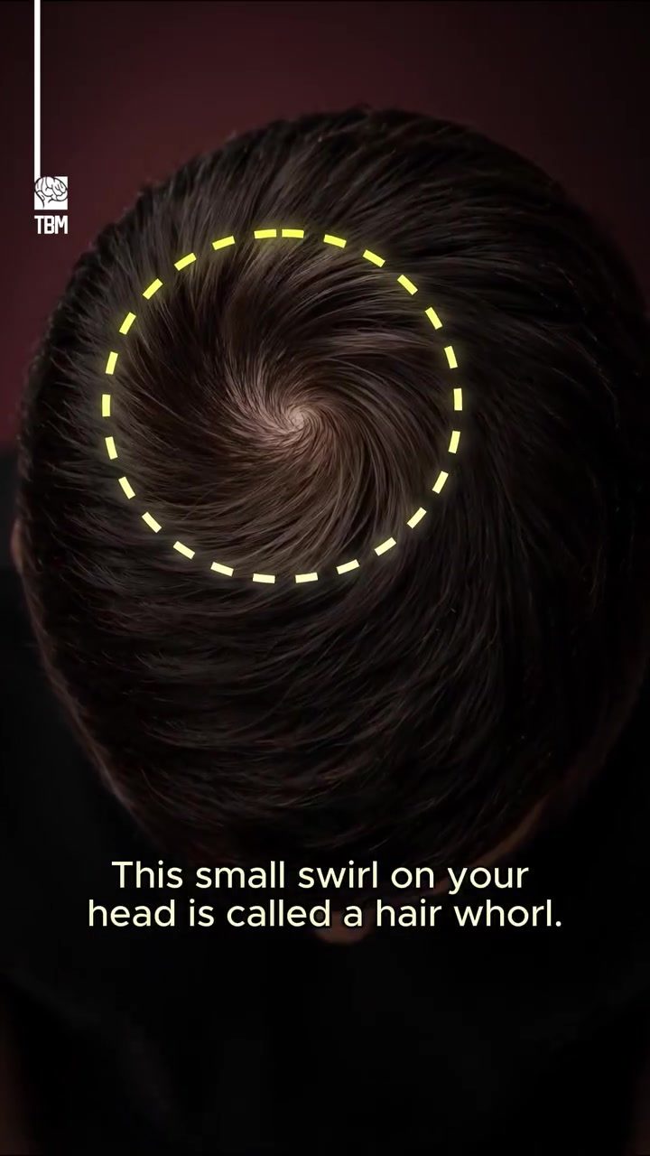 The Science of Hair Whorls on the Scalp