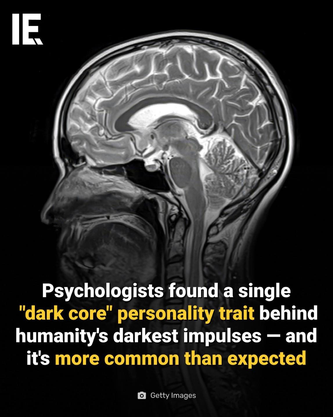 The Dark Core of Humanity: Unveiling the D Factor