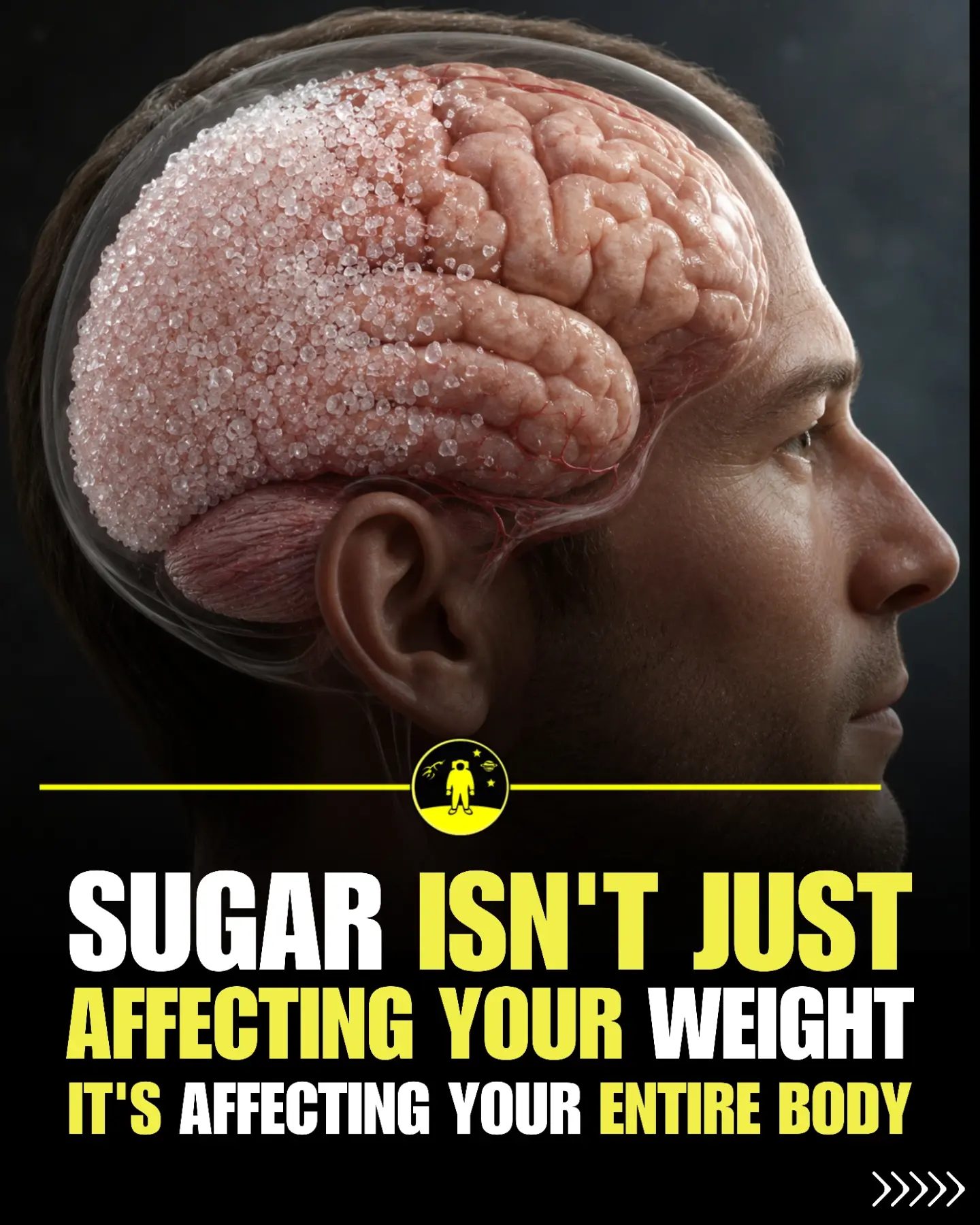 The Truth About Added Sugars & Disease