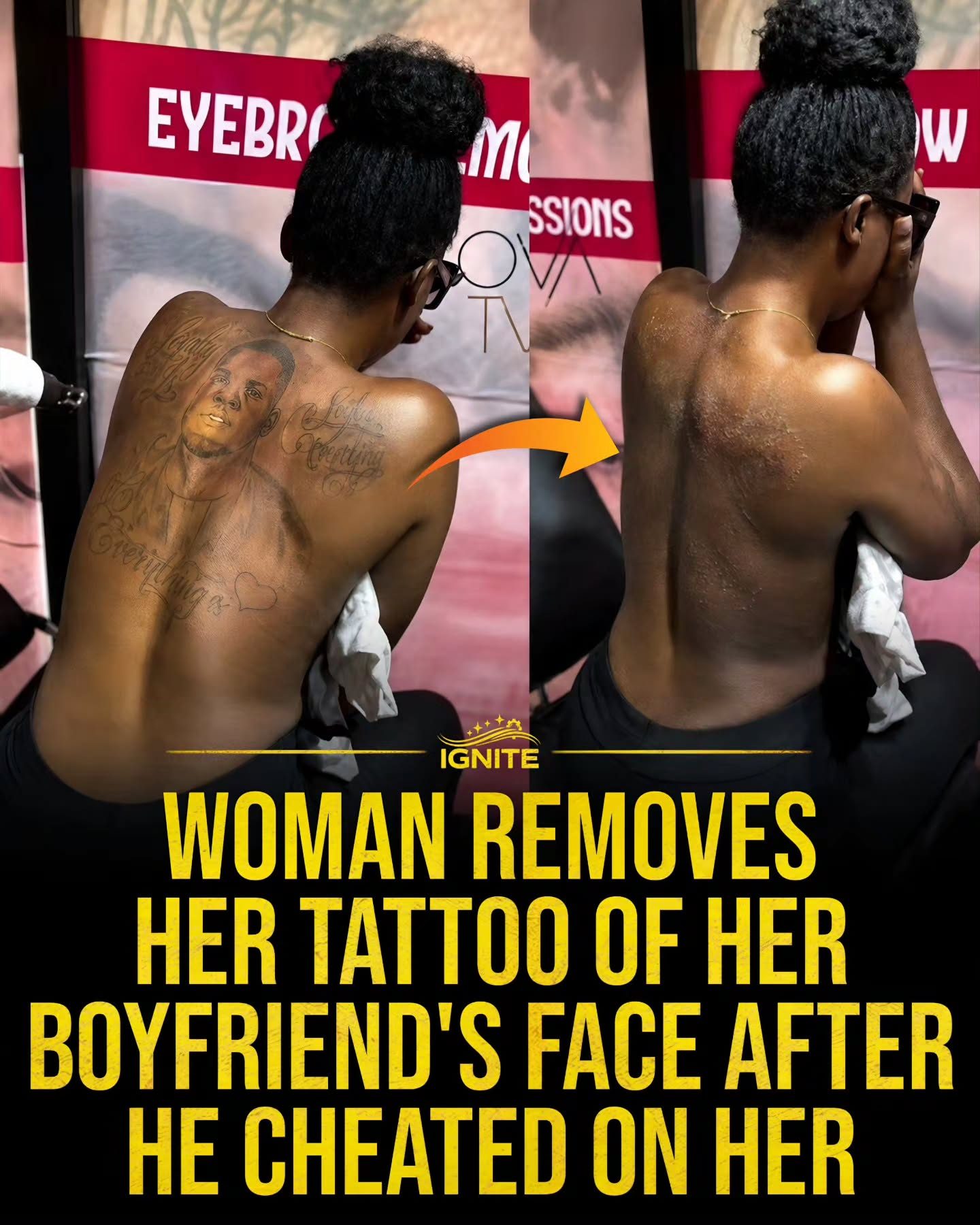 Tattoo Removal After Breakup: The Emotional Journey
