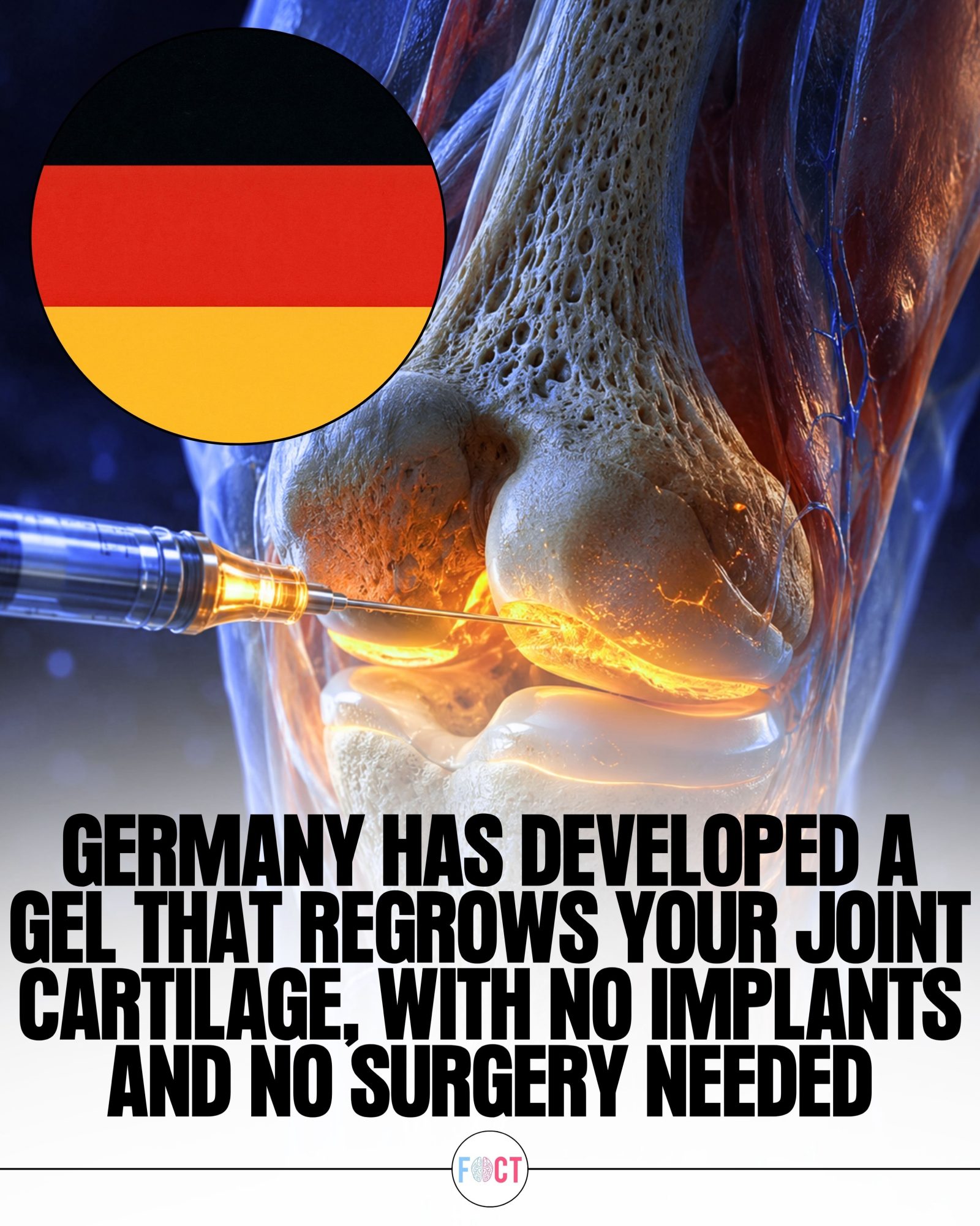 Germany's Breakthrough: Joint Cartilage Regeneration Gel