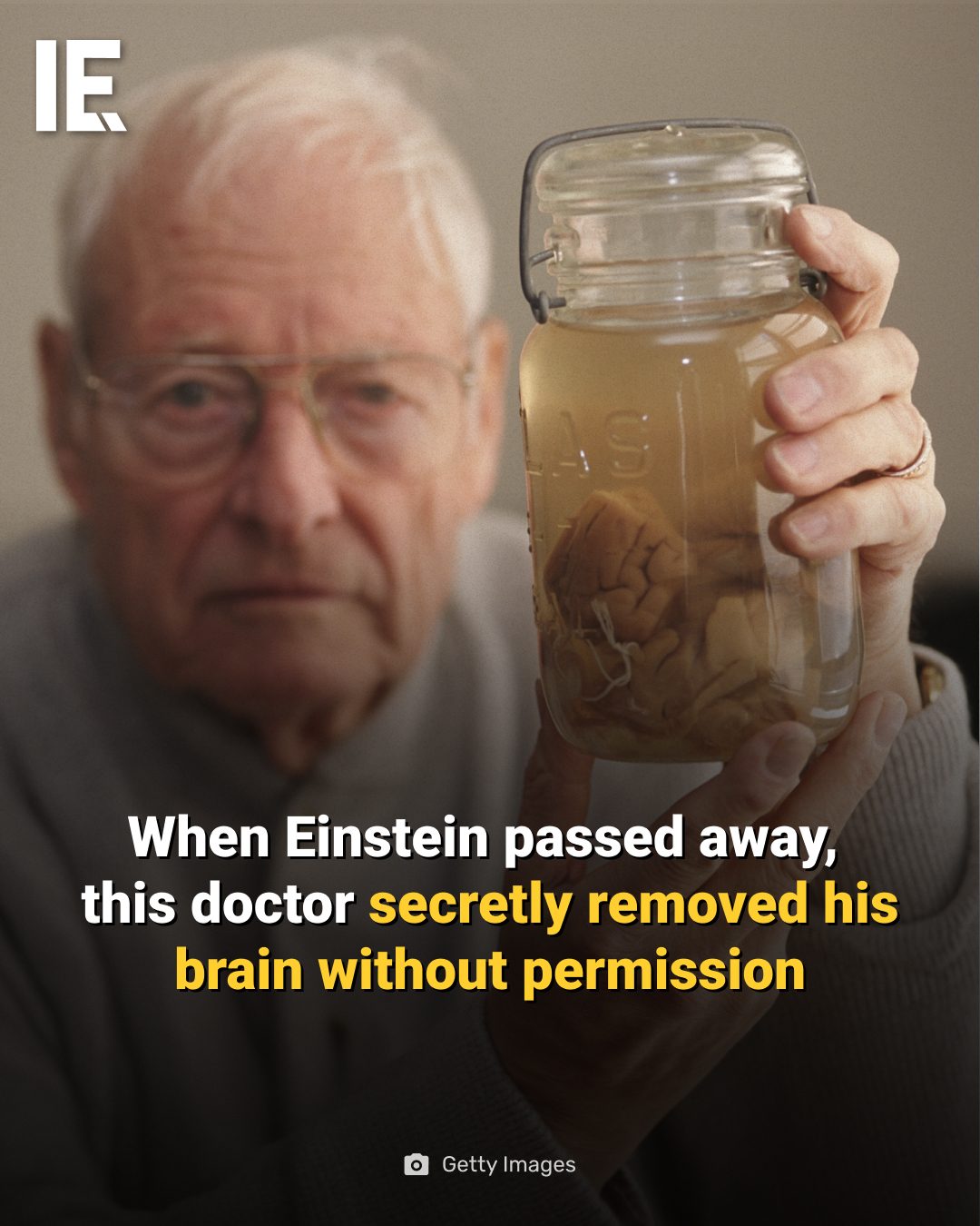 The Strange Fate of Einstein's Brain: A Post-Mortem Controversy
