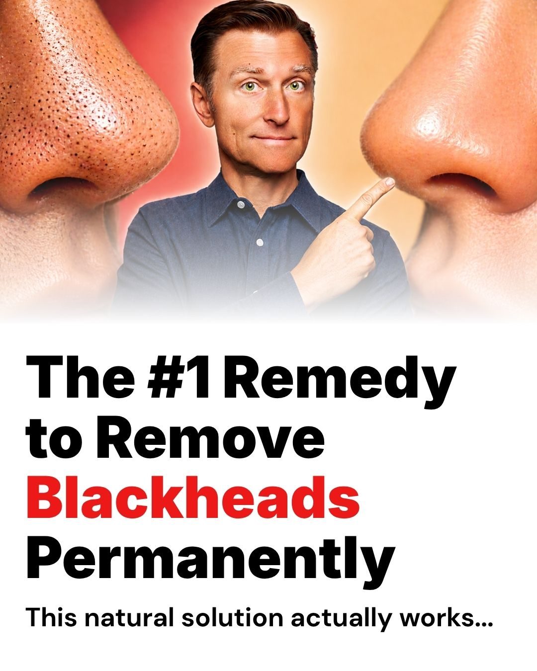 **Discover the Root Cause of Blackheads: Natural Remedy**