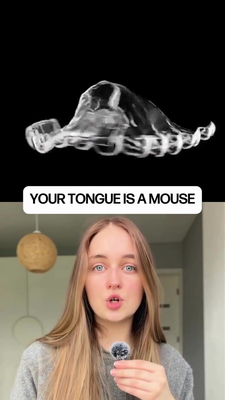 MouthPad: Augmental’s Tongue-Controlled Device Innovation