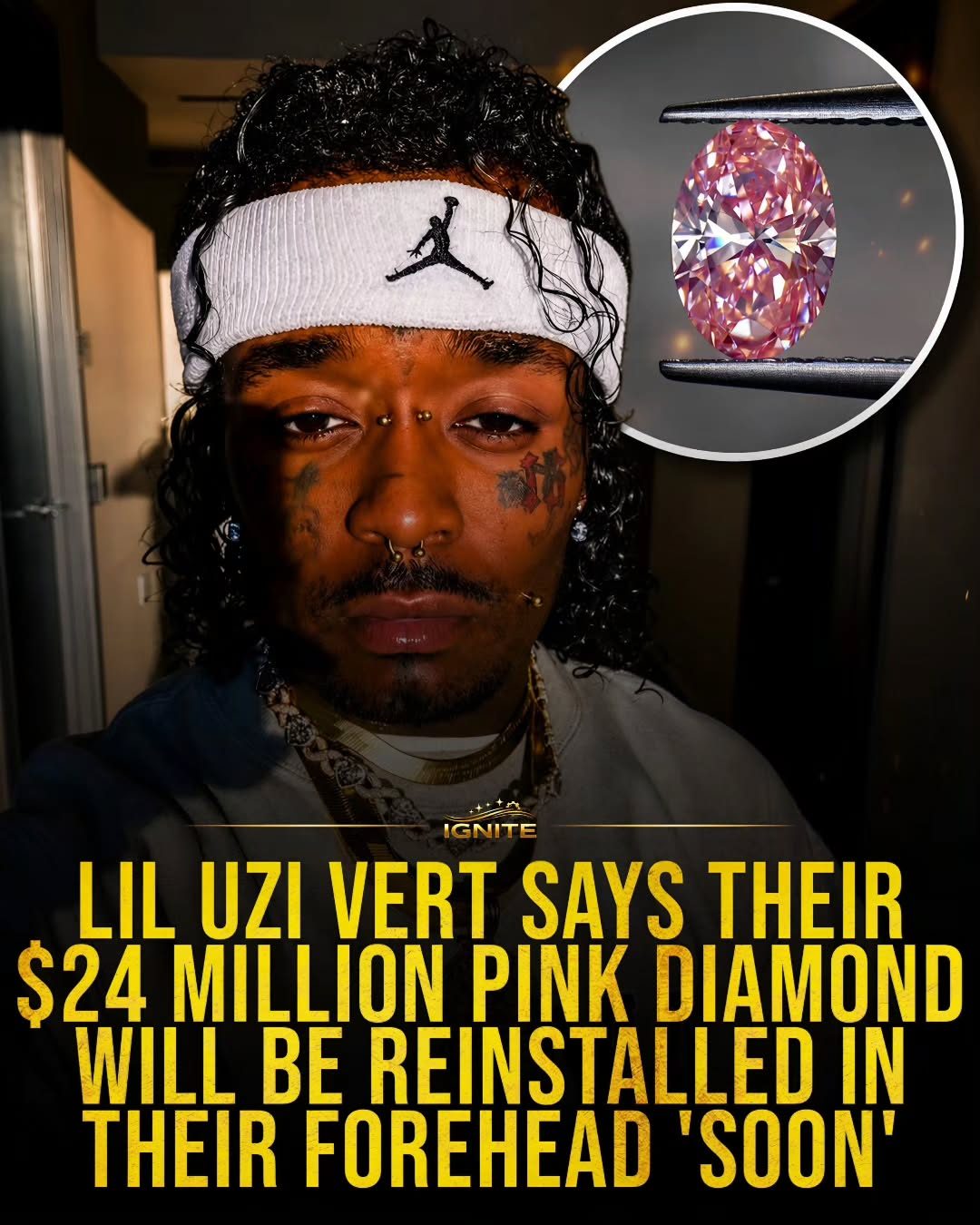 Lil Uzi Vert's Iconic $24M Diamond Return
