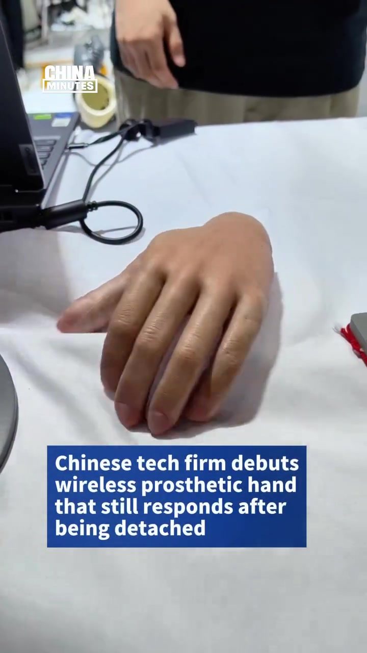 BrainCo Unveils Wireless Prosthetic Hand with Independent Movement