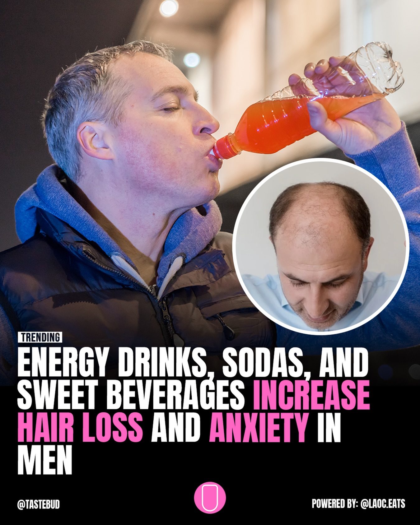 Sugary Drinks: Hair Loss & Anxiety Risks for Men
