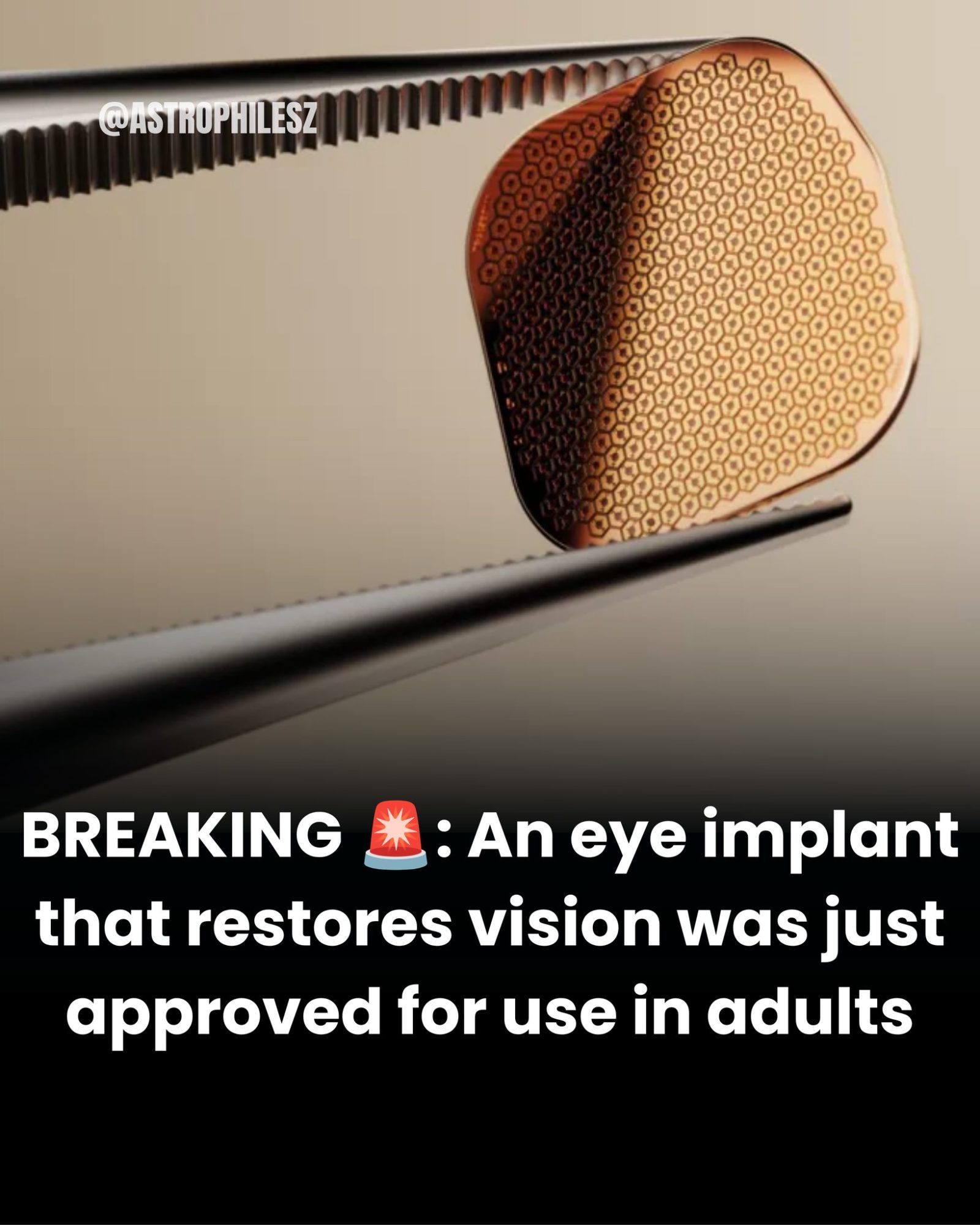 Eye Implant Approval: PRIMA Restores Vision for Millions