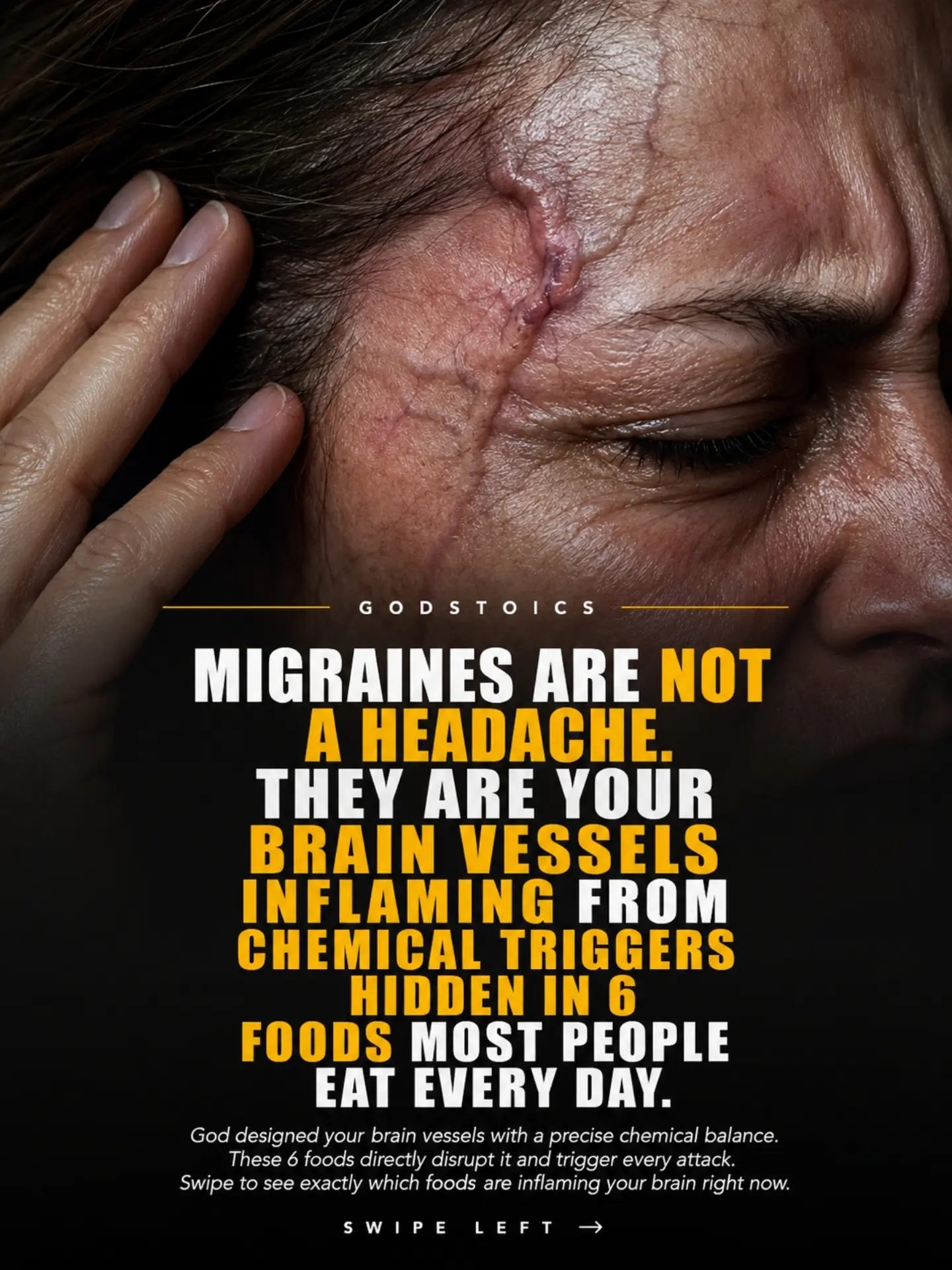 Migraine Triggers: Foods to Avoid for Brain Health