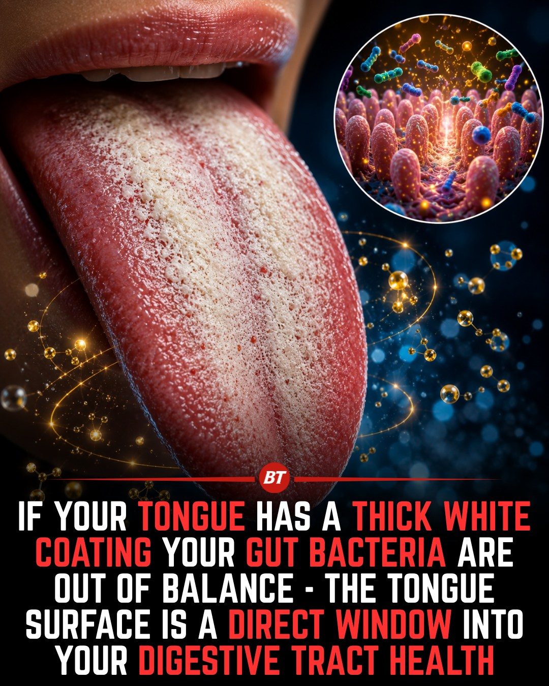 The Surprising Link Between Tongue Health and Gut Bacteria