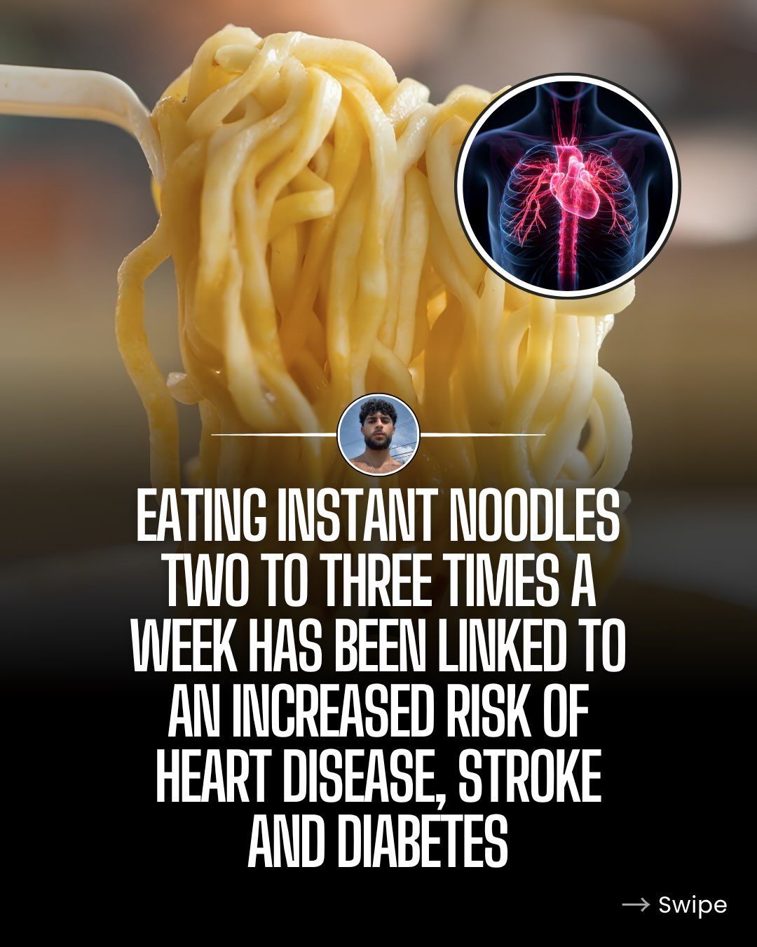 Instant Noodles: Health Risks of Regular Consumption