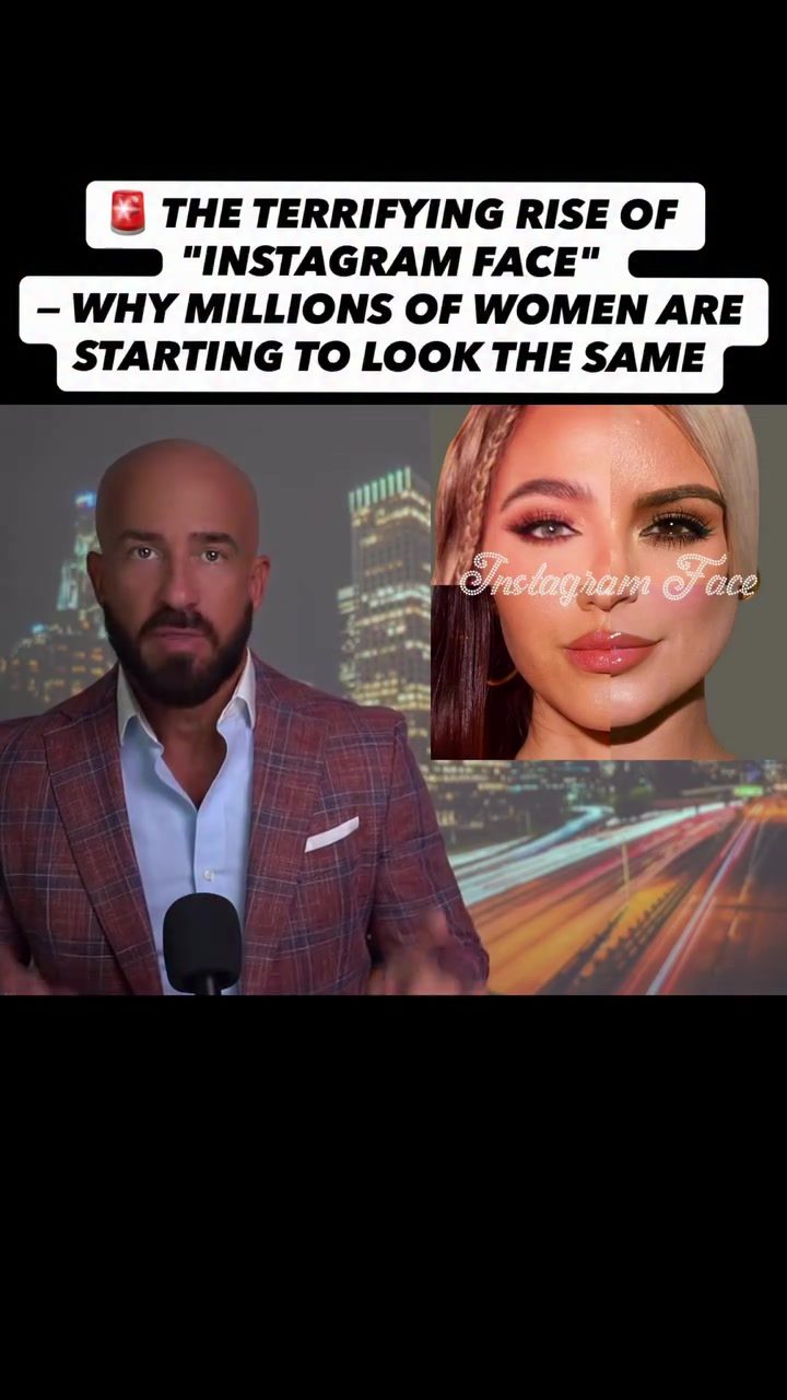 Instagram Face Trend: How Social Media Is Changing Women's Appearances