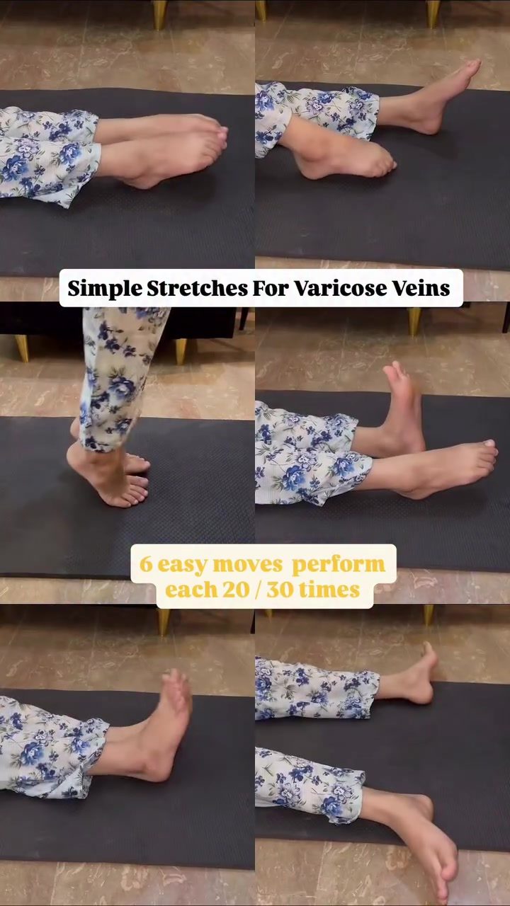Easy Stretches to Alleviate Varicose Vein Discomfort