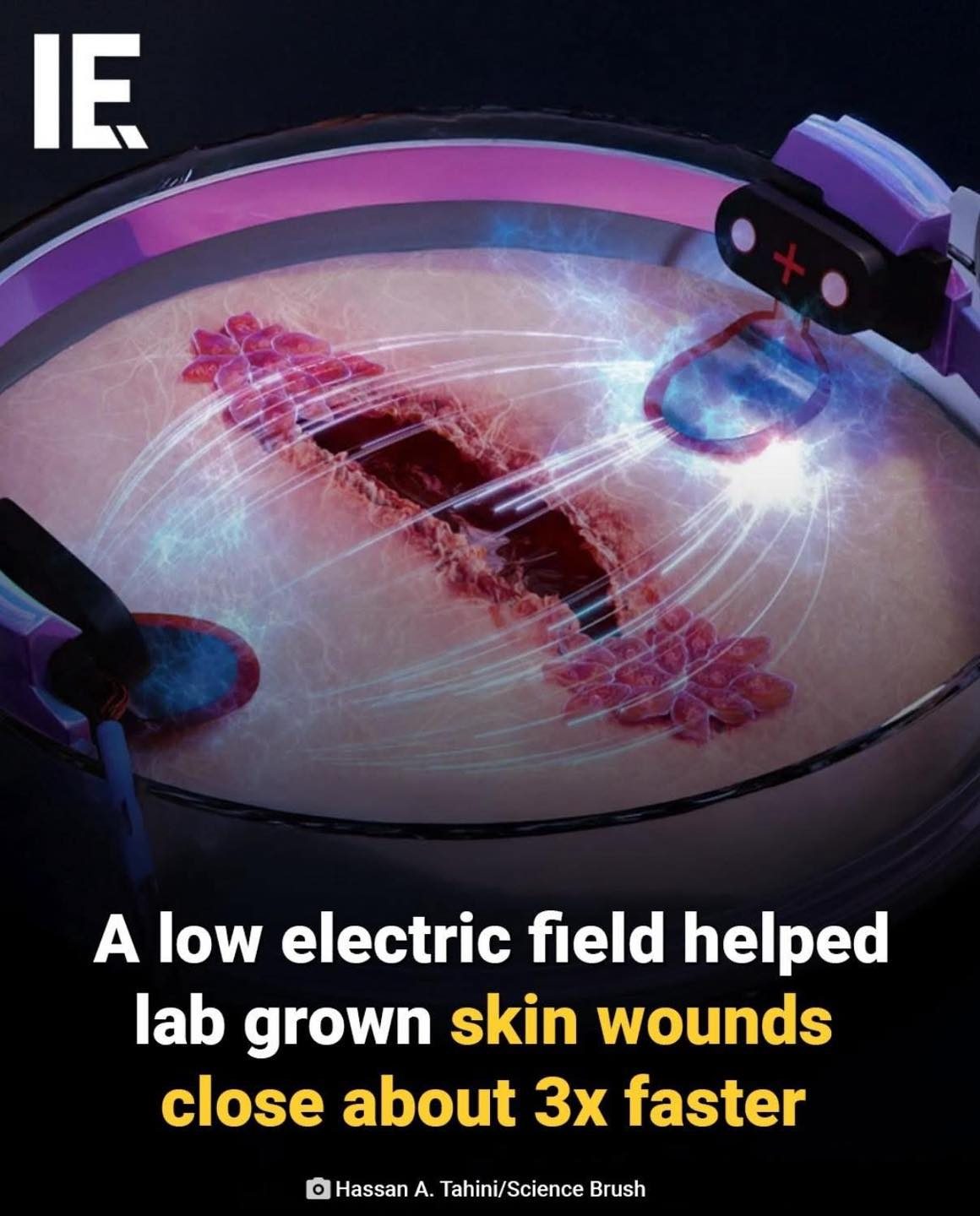 Lab-Grown Skin Healing Accelerated with Electric Fields