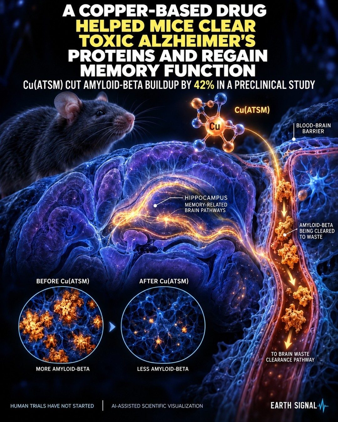 Alzheimer's Drug Cu(ATSM) Shows Promise in Mice