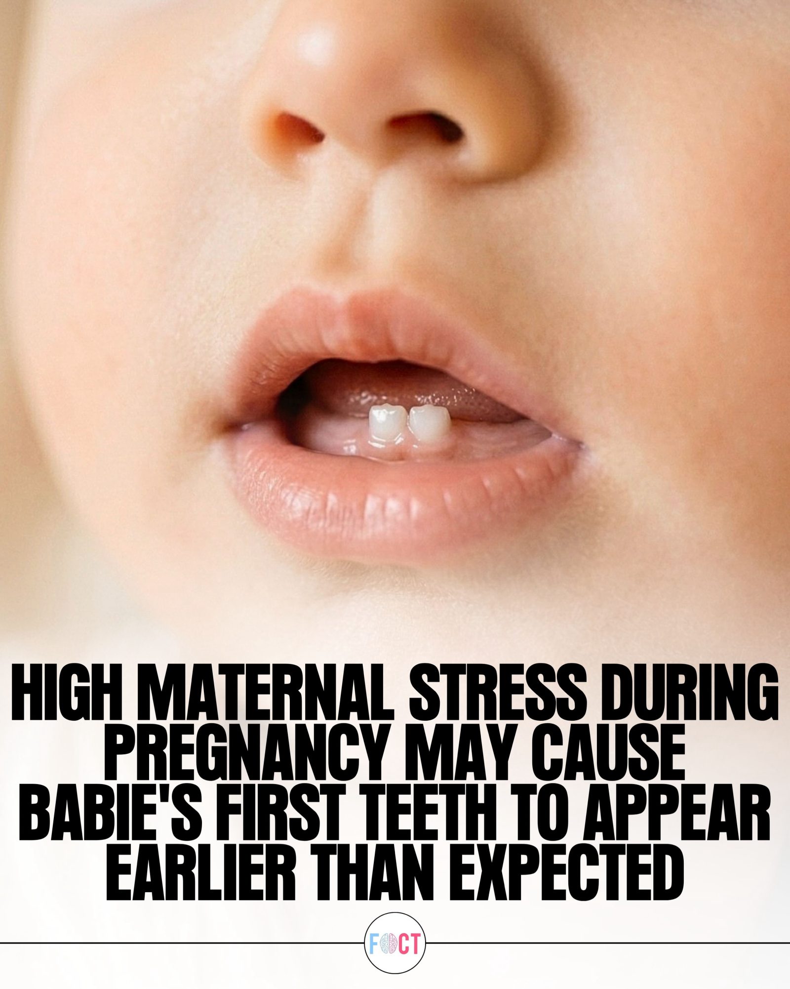 How Stress in Late Pregnancy Affects Your Baby's Teeth