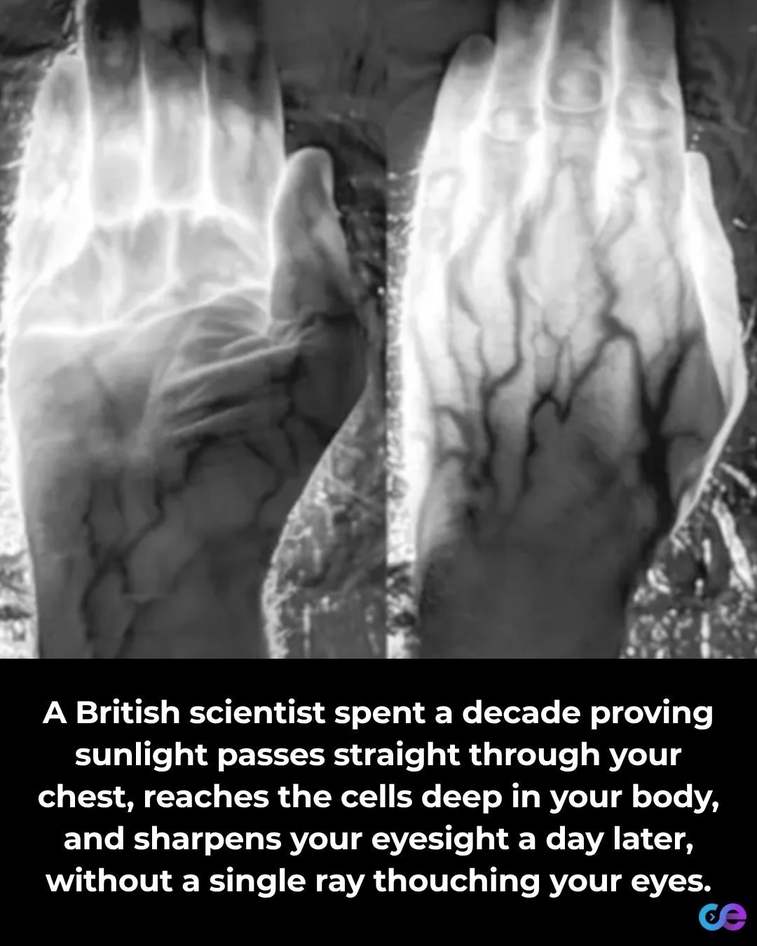 ### Sunlight's Surprising Impact On Vision Through the Body
