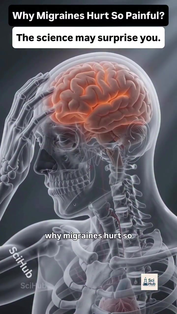 Understanding Migraine Pain: The Neurological Cause
