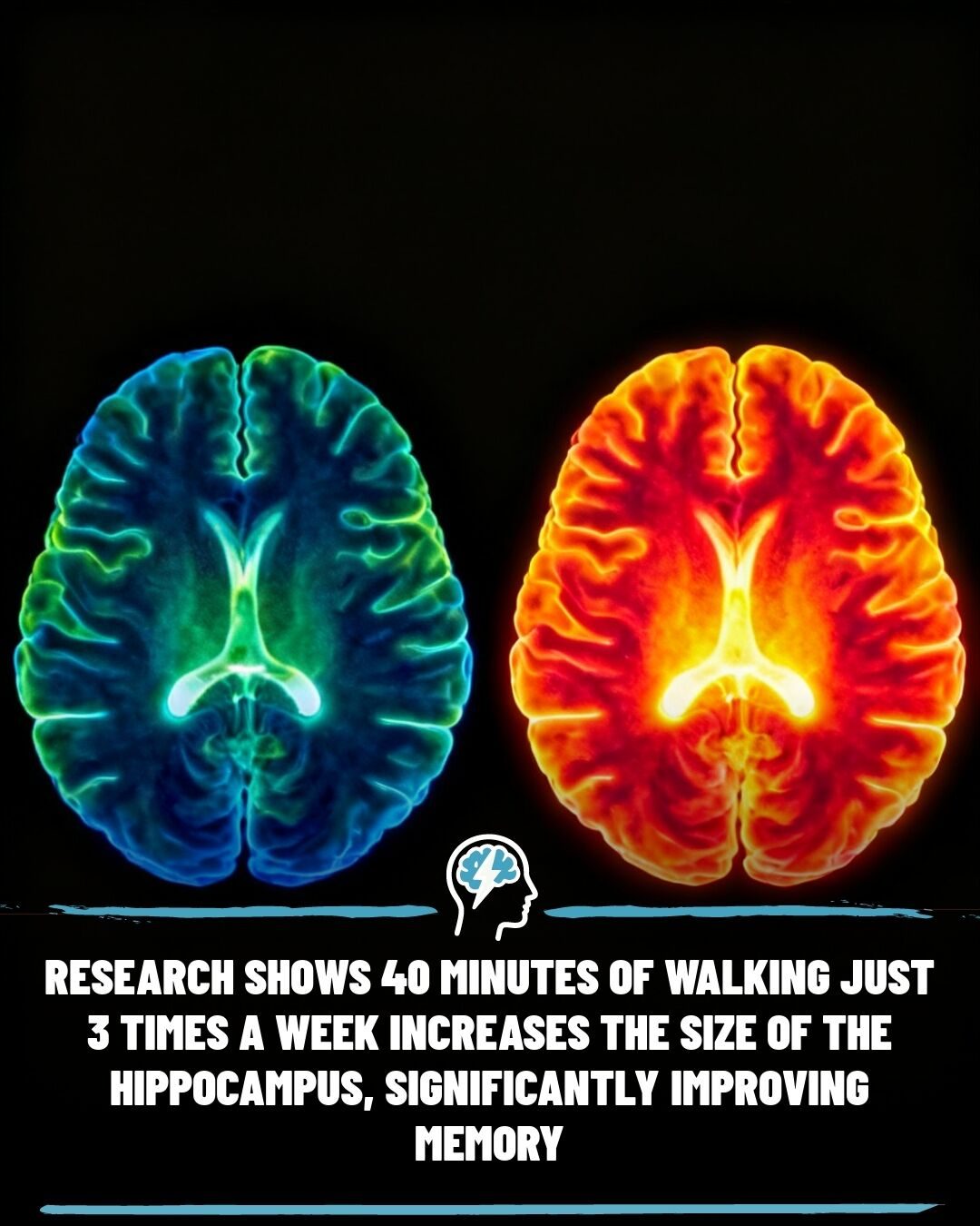 Walking Boosts Memory: How 40 Minutes, 3x a Week Can Help