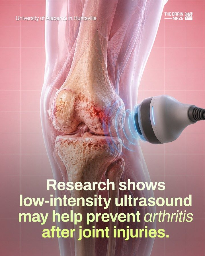 Low-Intensity Ultrasound May Prevent Post-Traumatic Arthritis