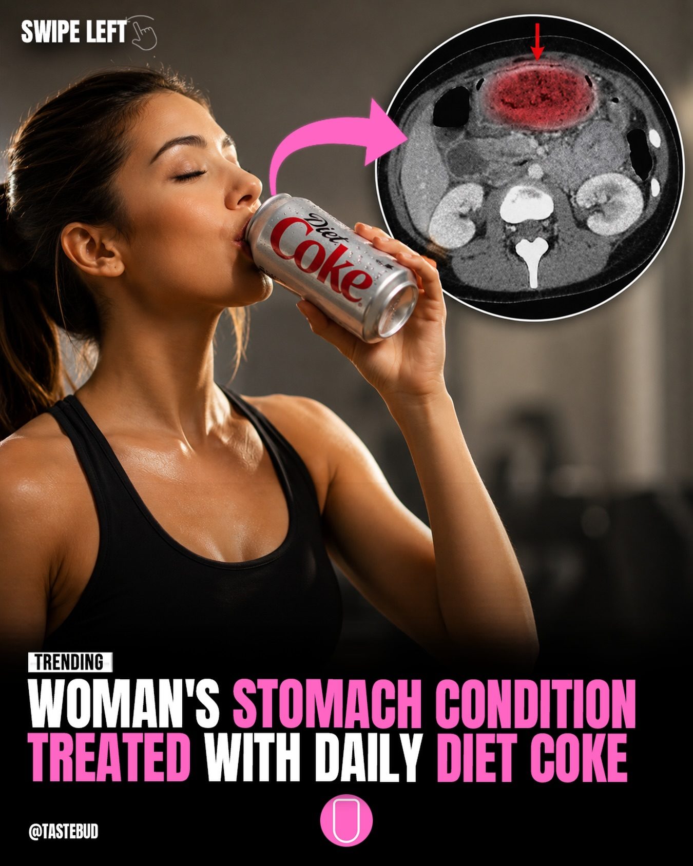 Surprising Medical Use for Diet Coke: Dissolving Stomach Blockages