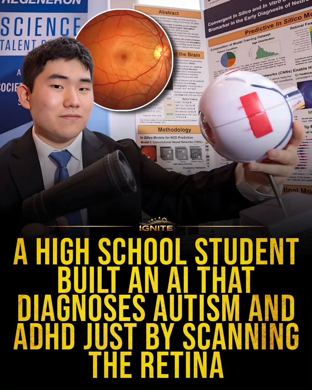 High School Student Develops AI for Early Autism and ADHD Diagnosis