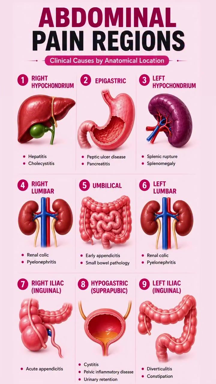 Understanding Abdominal Pain by Region: Causes and Clues