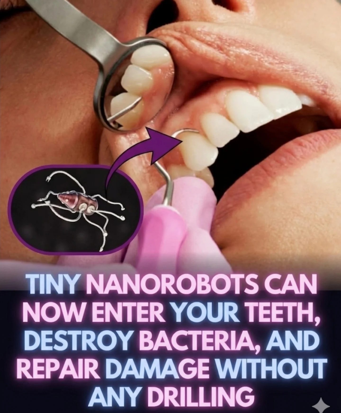 Revolutionizing Dentistry: Nanorobots' Role in Precise Oral Care