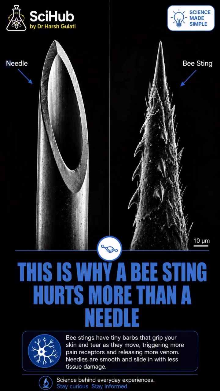 The Surprising Science Behind Bee Stings vs. Needles