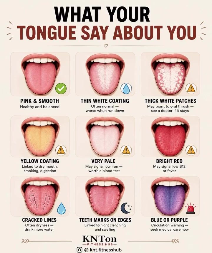 Tongue Health: What Your Tongue Says About Your Wellness