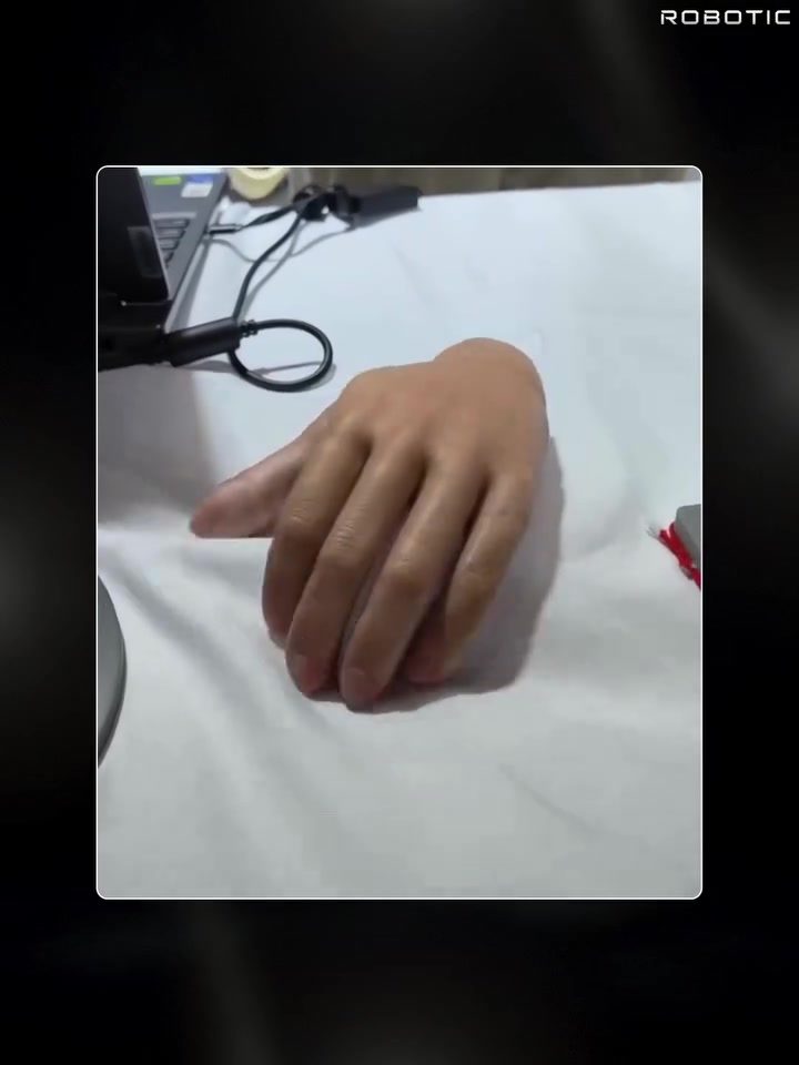 How AI-Powered Bionic Hands Are Changing Prosthetics