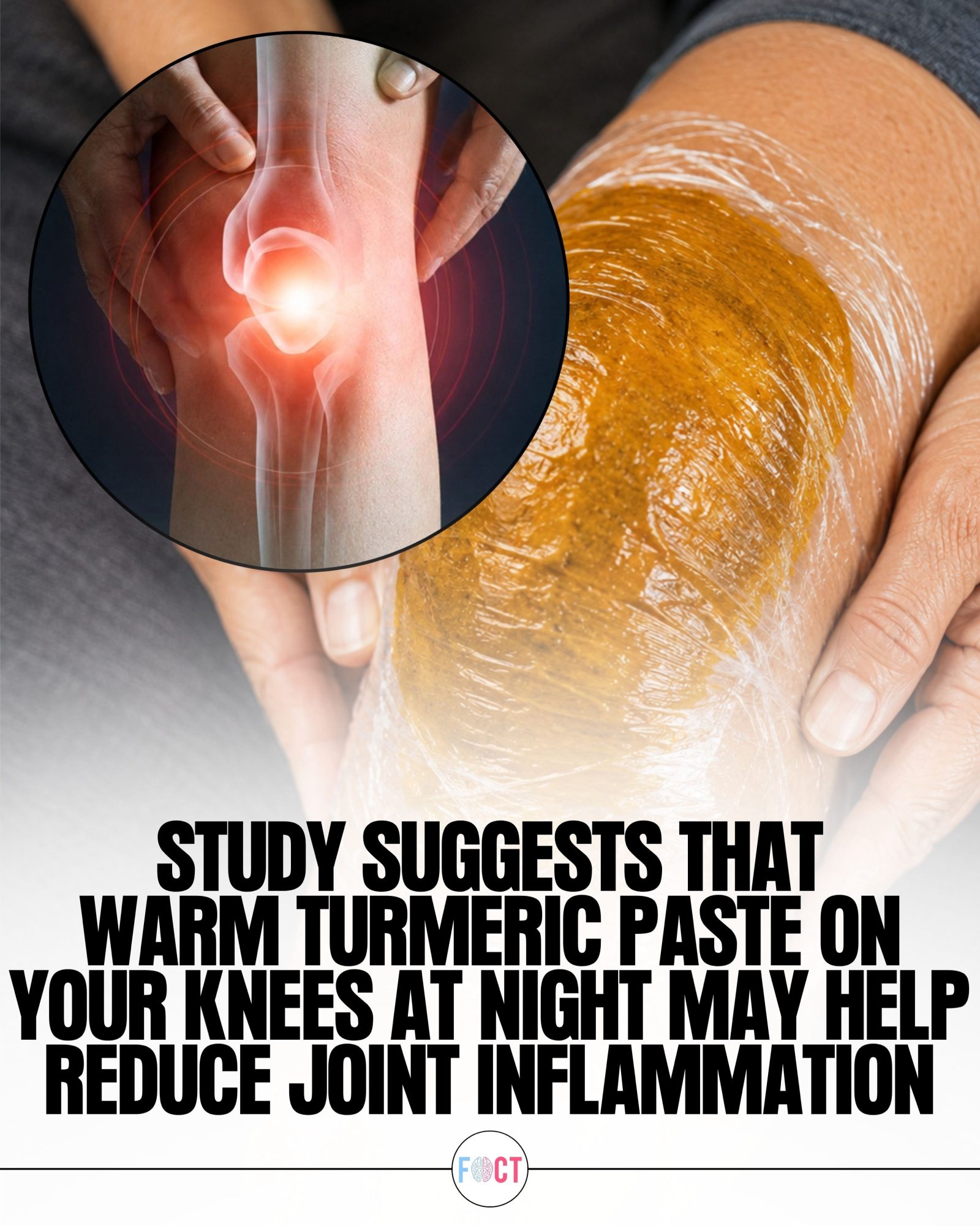 Turmeric Paste for Knee Pain: Does It Work?