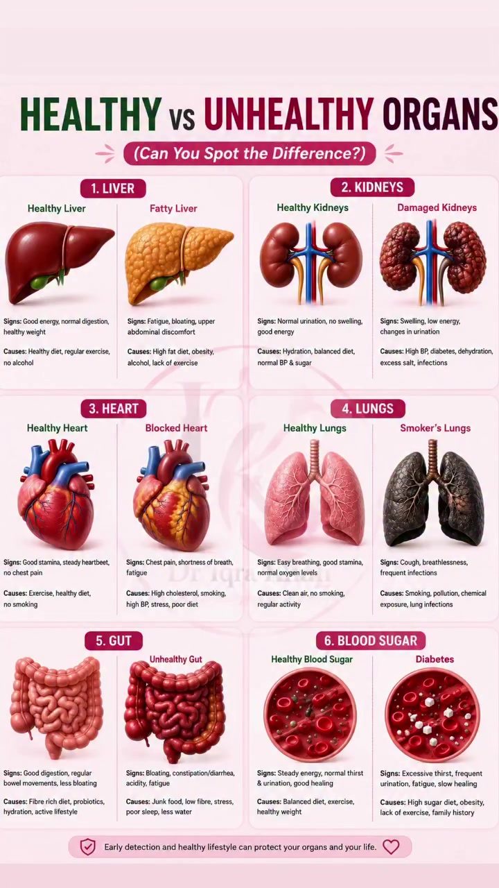 Learn to Spot the Difference: Healthy vs. Unhealthy Organs