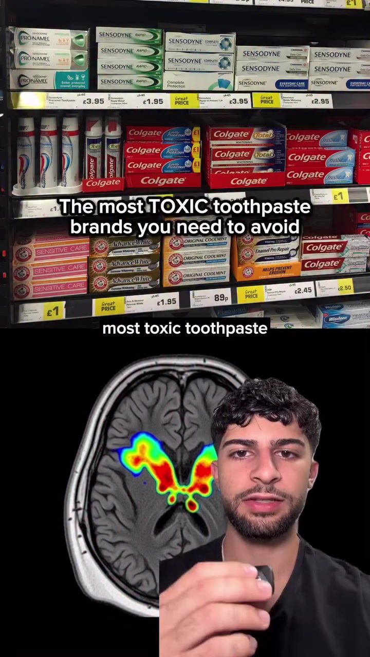 Toxic Toothpaste Brands to Avoid