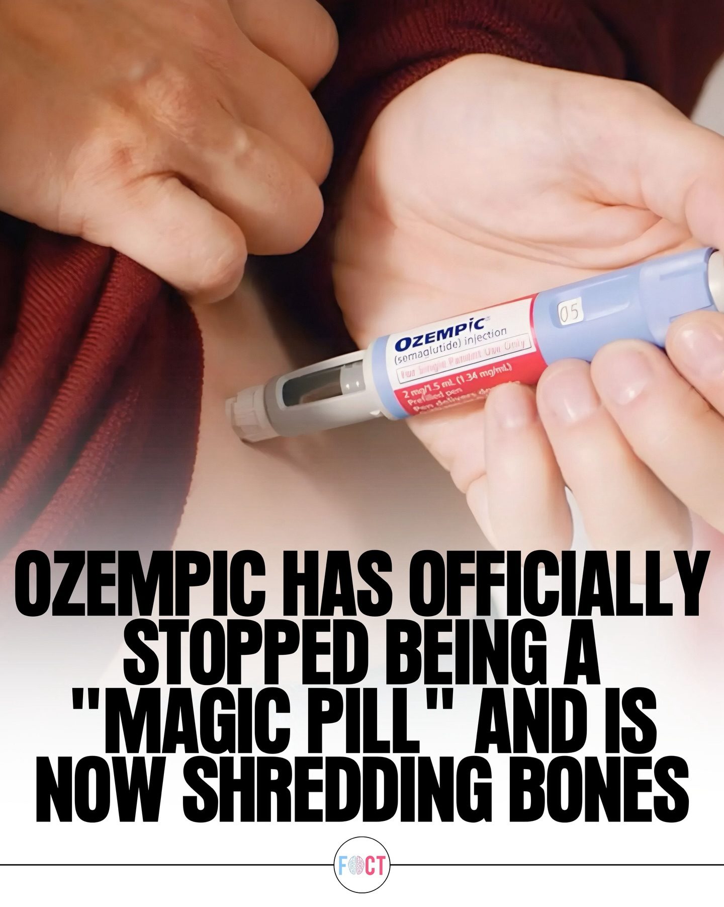 Ozempic and Bone Health: New Concerns for Diabetics