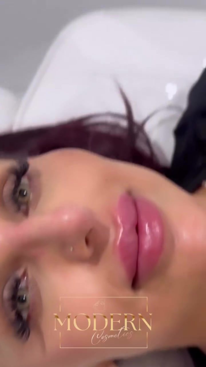 Discover the Modern Cosmetics Lip Filler Experience