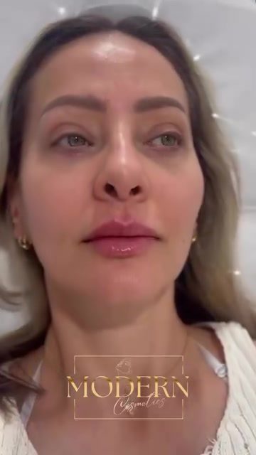 Customized Cosmetic Treatments at Modern Cosmetics