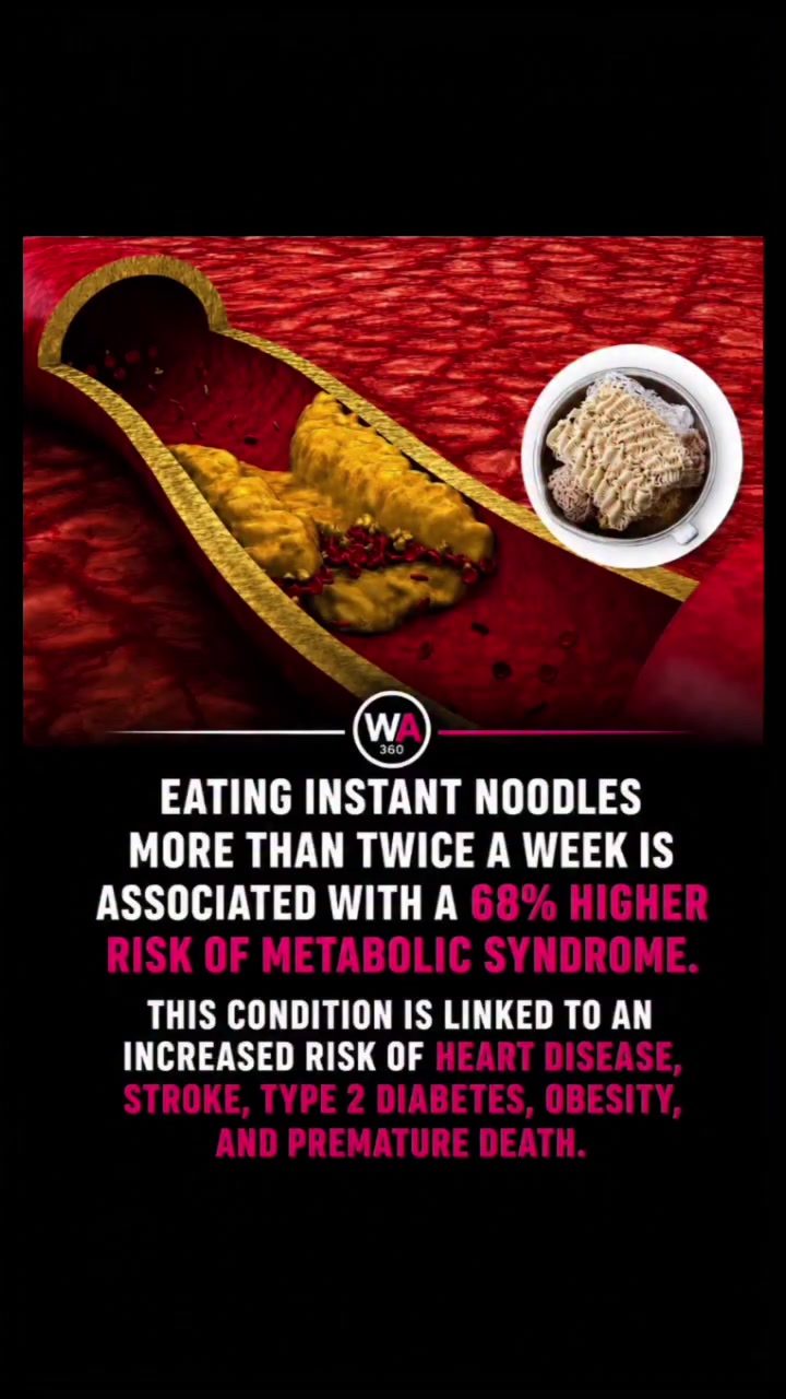 Health Alert: Dangers of Eating Instant Noodles More Twice a Week