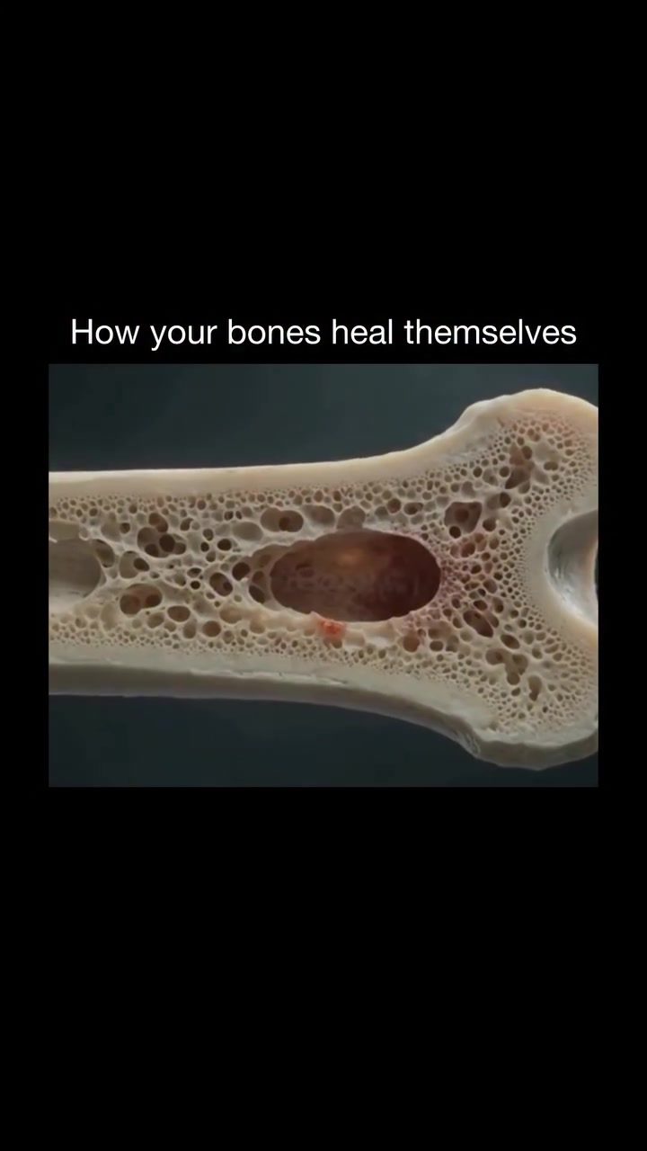 The Amazing Process of Bone Regeneration